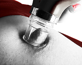 aspiration du t&eacute;ton 